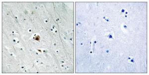 Immunohistochemical analysis of paraffin-embedded human brain using Anti-MAPKAPK2 (phospho Ser272) Antibody The right hand panel represents a negative control, where the antibody was pre-incubated with the immunising peptide