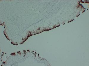 Immunohistochemical analysis of paraffin-embedded human Bladder using Anti-Uroplakin III Antibody