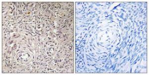 Immunohistochemical analysis of paraffin-embedded human ovary tissue using Anti-GCNT7 Antibody. The right hand panel represents a negative control, where the Antibody was pre-incubated with the immunising peptide