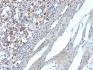 Immunohistochemical analysis of formalin-fixed, paraffin-embedded human kidney using Anti-RAD51 Antibody [RAD51/2856]