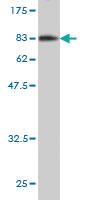 Anti-EIF4G3 Mouse Monoclonal Antibody [clone: 1H5]