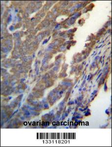 Anti-ASB4 Rabbit Polyclonal Antibody (APC (Allophycocyanin))