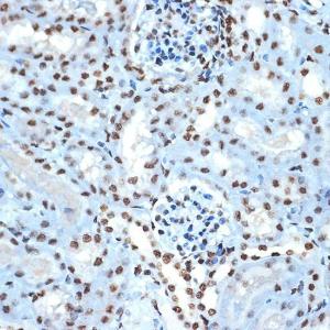 Immunohistochemistry analysis of paraffin-embedded mouse kidney using Anti-Histone H2B Antibody [ARC2337] (A306466) at a dilution of 1:100 (40x lens). Perform microwave antigen retrieval with 10 mM Tris/EDTA buffer pH 9.0 before commencing with IHC staining protocol.