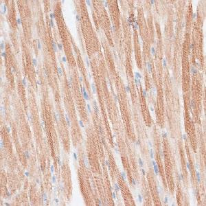 Immunohistochemistry analysis of paraffin-embedded mouse heart using Anti-GRK5 Antibody (A11696) at a dilution of 1:100 (40x lens). Perform microwave antigen retrieval with 10 mM PBS buffer pH 7.2 before commencing with IHC staining protocol