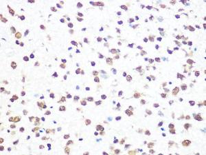 Anticorps monoclonal de lapin anti-Aly/Ref [Clone : ARC0959]