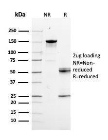 SDS-PAGE analysis of Anti-RAD51 Antibody [RAD51/2856] under non-reduced and reduced conditions; showing intact IgG and intact heavy and light chains, respectively. SDS-PAGE analysis confirms the integrity and purity of the antibody.