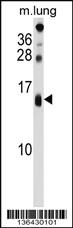 Anti-DEXI Rabbit Polyclonal Antibody