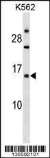 Anti-EMP1 Rabbit Polyclonal Antibody (FITC (Fluorescein Isothiocyanate))