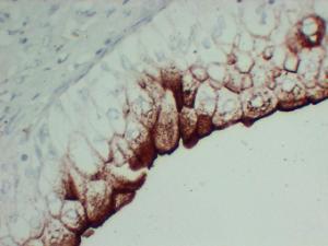 Immunohistochemical analysis of paraffin-embedded human Bladder-High magnification using Anti-Uroplakin III Antibody