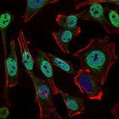 Anti-NBS1 Mouse Monoclonal Antibody [clone: 7E4A2]