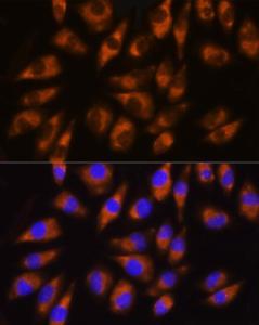 Immunofluorescence analysis of L929 cells using Anti-GRK5 Antibody (A11696) at a dilution of 1:100 (40x lens). DAPI was used to stain the cell nuclei (blue)