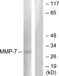 Western blot analysis of lysates from COS7 cells using Anti-MMP-7 Antibody The right hand lane represents a negative control, where the antibody is blocked by the immunising peptide