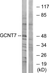 Western blot analysis of lysates from K562 cells using Anti-GCNT7 Antibody. The right hand lane represents a negative control, where the Antibody is blocked by the immunising peptide