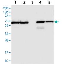 Anti-TMCO6 Rabbit Polyclonal Antibody