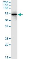 Anti-FKBP10 Mouse Monoclonal Antibody [clone: 2D4]