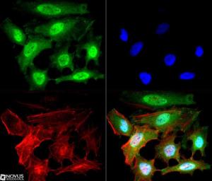 Anti-NBS1 Mouse Monoclonal Antibody [clone: 7E4A2]