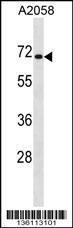 Anti-CPEB1 Rabbit Polyclonal Antibody (HRP (Horseradish Peroxidase))