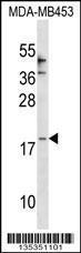 Anti-CCL25 Rabbit Polyclonal Antibody (HRP (Horseradish Peroxidase))