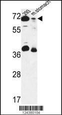 Anti-GSPT2 Rabbit Polyclonal Antibody (HRP (Horseradish Peroxidase))