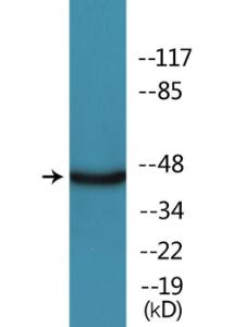 Anti-MAPKAPK2/3 Rabbit Polyclonal Antibody