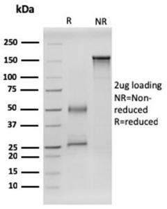 SDS-PAGE analysis of Anti-RET Antibody [RET/2599] under non-reduced and reduced conditions; showing intact IgG and intact heavy and light chains, respectively. SDS-PAGE analysis confirms the integrity and purity of the antibody