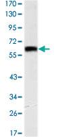 Anti-OTX2 Mouse Monoclonal Antibody [clone: 1H12C4B5]