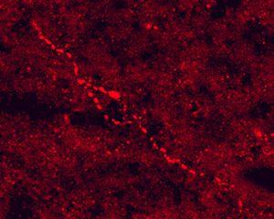 Immunohistochemical staining in rat hypothalamus. 4% paraformaldehyde fixed rat brain crystostat sections (10 µm) were incubated overnight at 4°C with Rabbit polyclonal antibody to Adrenocorticotropic hormone (5 µg/ml).