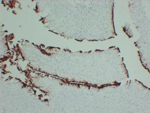 Immunohistochemical analysis of paraffin-embedded human Bladder using Anti-Uroplakin III Antibody