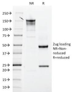 SDS-PAGE analysis of Anti-Integrin beta 3 Antibody [ITGB3/2145] under non-reduced and reduced conditions; showing intact IgG and intact heavy and light chains, respectively. SDS-PAGE analysis confirms the integrity and purity of the antibody