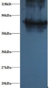 Anti-PSMB4 Rabbit Polyclonal Antibody