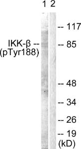 Western blot analysis of lysates from COS7 cells using Anti-IKK-beta (phospho Tyr188) Antibody. The right hand lane represents a negative control, where the Antibody is blocked by the immunising peptide