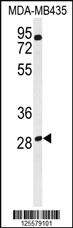 Anti-RRAGD Rabbit Polyclonal Antibody