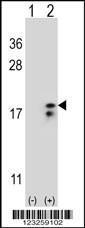 Anti-COX6A1 Rabbit Polyclonal Antibody (HRP (Horseradish Peroxidase))