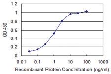 Anti-FKBP10 Mouse Monoclonal Antibody [clone: 2D4]