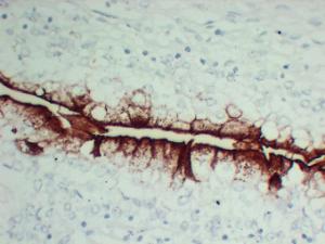 Immunohistochemical analysis of paraffin-embedded human Bladder-High magnification using Anti-Uroplakin III Antibody