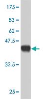 Anti-GYG2 Mouse Monoclonal Antibody [clone: 3D10]