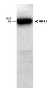 Anti-NBS1 Rabbit Polyclonal Antibody