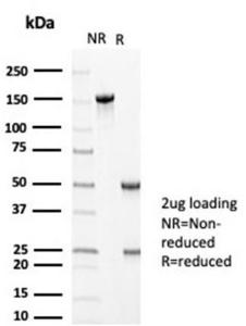 SDS-PAGE analysis of Anti-MLH1 Antibody [MLH1/6710] under non-reduced and reduced conditions; showing intact IgG and intact heavy and light chains, respectively SDS-PAGE analysis confirms the integrity and purity of the antibody