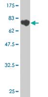 Anti-HCV-E2 Mouse Monoclonal Antibody [clone: 2F5]