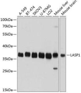 Western blot analysis of extracts of various cell lines, using Anti-LASP1 Antibody (A11701) at 1:1,000 dilution