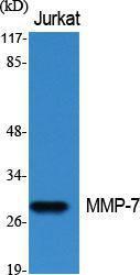 Western blot analysis of various cells using Anti-MMP-7 Antibody