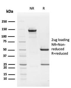 Anti-Rb1 antibody