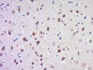 Formalin-fixed and paraffin embedded Rat Brain tissue labeled with SAPAP4/DLGAP4 Polyclonal Antibody (bs-12140R) at 1:200, followed by conjugation to the seconary antibody and DAB staining