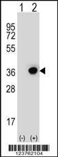 Anti-DHRS3 Rabbit Polyclonal Antibody (AP (Alkaline Phosphatase))