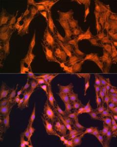 Immunofluorescence analysis of C6 cells using Anti-LASP1 Antibody (A11701) at a dilution of 1:100 (40X lens). DAPI was used to stain the cell nuclei (blue)