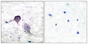 Antibody anti-PRESENILIN 1 100 µg