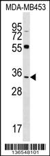 Anti-FKBP6 Rabbit Polyclonal Antibody