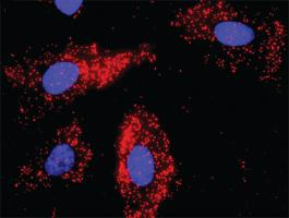 Anti-RAF1 Antibody Pair