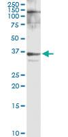 Anti-HMGCL Rabbit Polyclonal Antibody