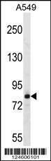 Anti-FSCB Rabbit Polyclonal Antibody (FITC (Fluorescein Isothiocyanate))